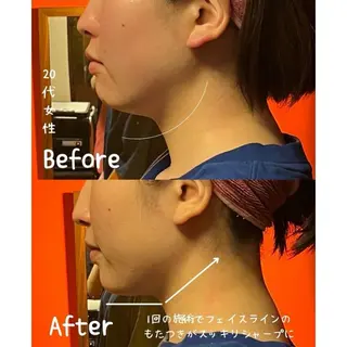 表情筋フェイシャル 三軒茶屋のエステ・リラクイメージ