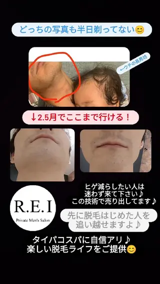 メンズ R.E.I　大学生 急増中！U22割有りのエステ・リラクイメージ