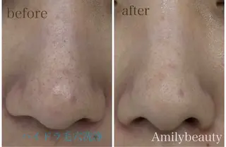 Amily beauty 毛利のエステ・リラクイメージ