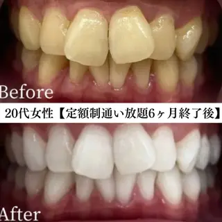 メンズ キッズ セルフホワイトニング WHITE福岡天神店のエステ・リラクイメージ