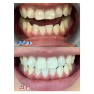 M渋谷 ホワイトニングのエステ・リラクイメージ