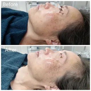 肌質改善Beauty salon Renのエステ・リラクイメージ