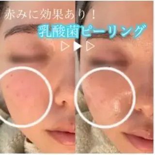 小顔コルギ・美肌 グラシーズのエステ・リラクイメージ