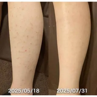 30minutes Rebeautyのエステ・リラクイメージ