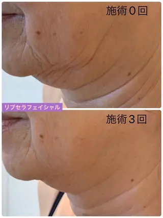 プライベートサロン プリュネルのエステ・リラクイメージ