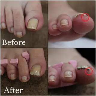 東 あきらのネイルデザイン