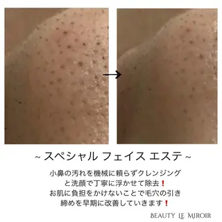 ビューティー ミロワールのエステ・リラクイメージ