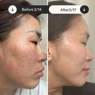 ラムーン アイラッシュ&ヘアメのマツエク・マツパデザイン