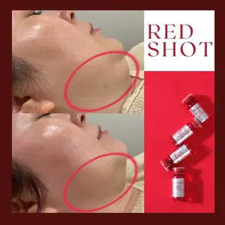 WAX/ララピール 酒井のエステ・リラクイメージ