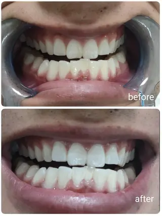 ecxia  white 　広島袋町店所属・セルフホワイトニング エクシア広島袋町店のその他イメージ