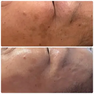 Beauty salon 705のエステ・リラクイメージ