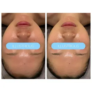 小顔コルギ ☆表参道/外苑前のエステ・リラクイメージ