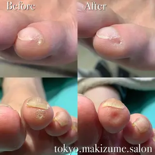 大宮巻き爪補正店所属・大宮 巻き爪補正店のエステ・リラクイメージ