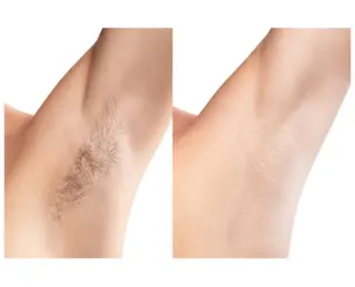 ツヤ肌脱毛サロン Grast🌿アイカのエステ・リラクイメージ