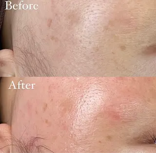 Cheri所属・丸山 彩乃のエステ・リラクイメージ