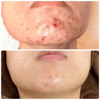 ビューティーホリック 東金店のエステ・リラクイメージ