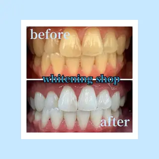 ホワイトニングショップ光明池店所属・ホワイトニング ショップ光明池店のエステ・リラクイメージ