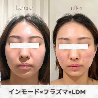 aimer 服部のその他イメージ