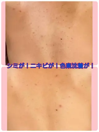 ハーブピーリング 専門店Kikkaのエステ・リラクイメージ