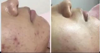 アトリエ ハルミナのネイルデザイン