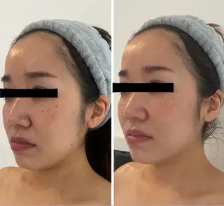 M.plus所属・水光韓国肌ハーブ ピーリングMplusのエステ・リラクイメージ