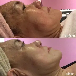 vi roots所属・vi rootsのエステ・リラクイメージ