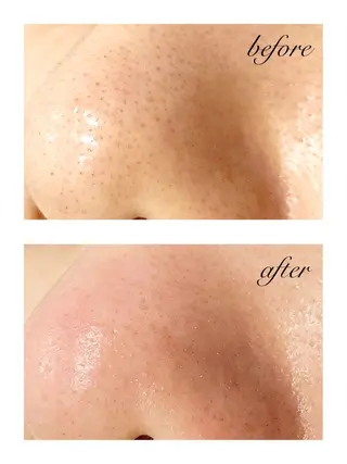 Seek lash&browのエステ・リラクイメージ