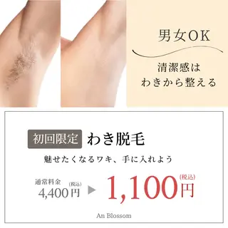 An Blossom所属・An Blossom 脱毛/茅ヶ崎/美咲のエステ・リラクイメージ