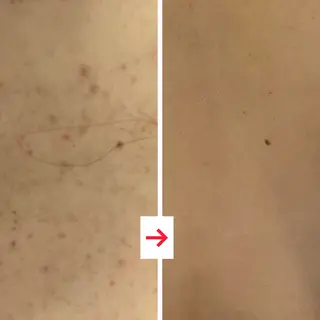 たるみ改善小顔エステ 堀葉月のその他イメージ