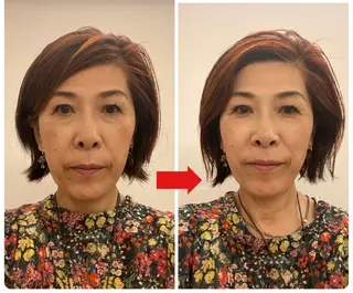 美容鍼サロン　それいゆ所属・鍼灸サロンそれいゆ 石河佳恵のエステ・リラクイメージ