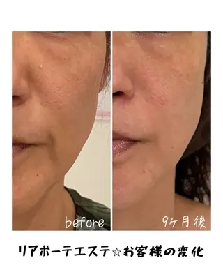 浜野 恵美のエステ・リラクイメージ