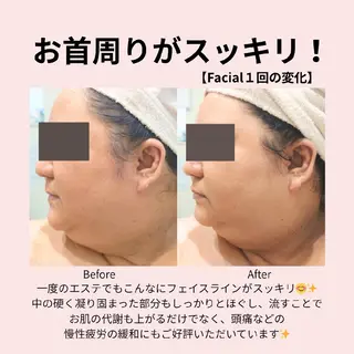 PRETTIEST SHINE所属・フェイシャル/ボディ /ブライダル山田浩子のエステ・リラクイメージ