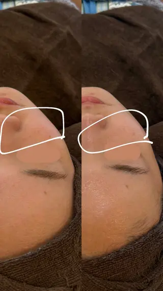 yukiko/美容師 髪質改善×肌質改善のエステ・リラクイメージ