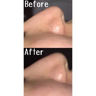 ゆか/エステサロン Lilasmileのエステ・リラクイメージ