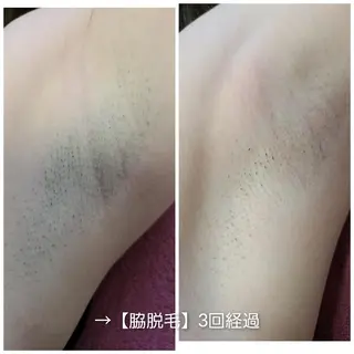 【トータル美容】 Eternityのその他イメージ