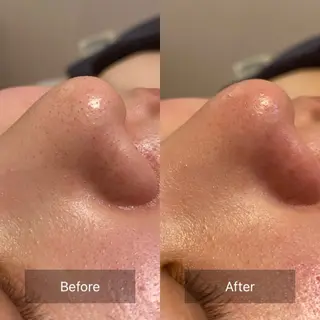 lumière d’espoirのエステ・リラクイメージ