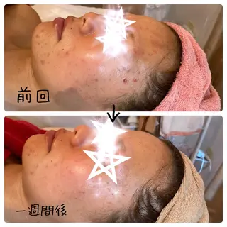 fairyrose organicエステのエステ・リラクイメージ