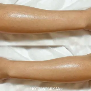 HOTEL&PARK .Moeワックス脱毛のエステ・リラクイメージ