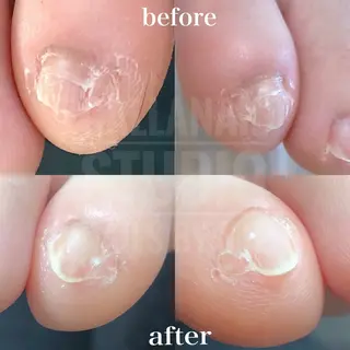 ネイル mie ミイのネイルデザイン