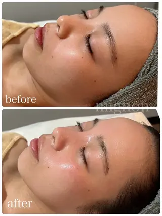 mignon /まつげパーマ・小顔のマツエク・マツパデザイン