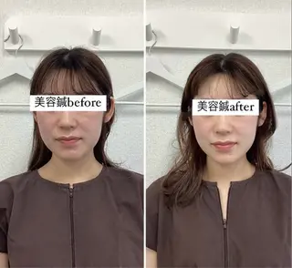 美容鍼灸×小顔整体♡ ハリサロンドオフ堺東のその他イメージ