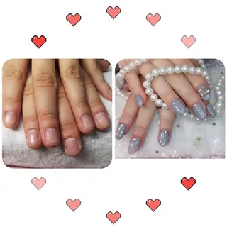 ショート ネイル フィルイン・深爪矯正 長さ出し🎀のネイルデザイン