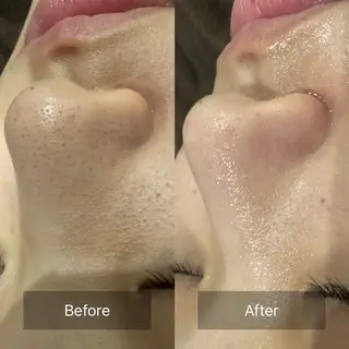 毛穴洗浄専門サロン/CareNa梅田【毛穴/ケアナ】所属・CareNa梅田店 🌿Mihoのエステ・リラクイメージ