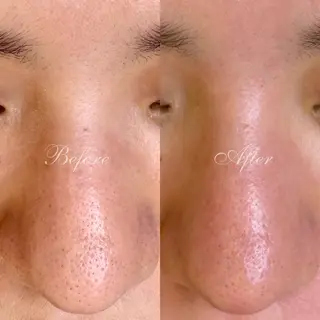 Miooo wax&beautyの眉毛・アイブロウイメージ