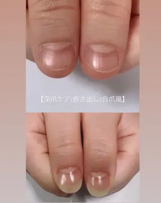 メンズ ネイル 爪ケア/深爪 自爪育成 🐰えむのネイルデザイン