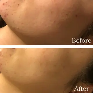 痩身専門サロン ビューティーグランツのエステ・リラクイメージ