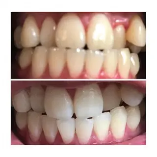 Ｍ渋谷 ホワイトニングのエステ・リラクイメージ