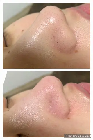 メンズ 朝重い人専用 肩甲骨調整のエステ・リラクイメージ