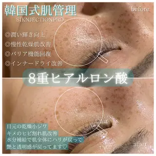 La Dusa 韓国肌管理/小波のエステ・リラクイメージ