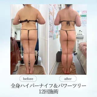 espresso,所属・《痩身、小顔専門店》 エスプレッソのエステ・リラクイメージ